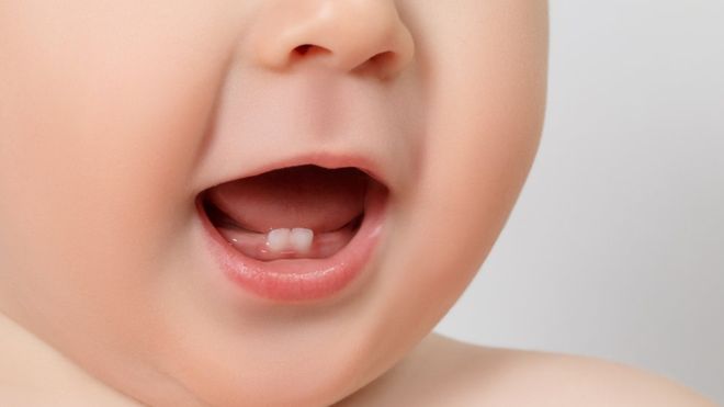 Bebé con dos dientes