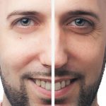 Hombre antes y después de las ojeras