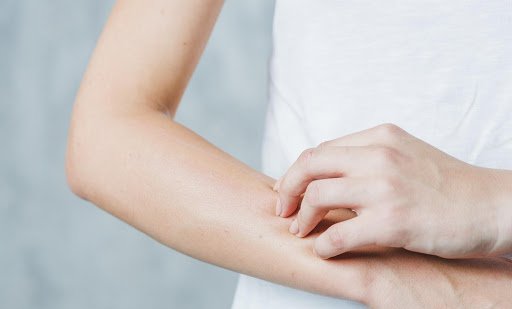 Mujer con brazos con comezón en los brazos